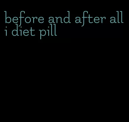 before and after alli diet pill