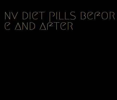 nv diet pills before and after