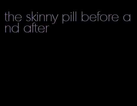 the skinny pill before and after