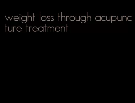 weight loss through acupuncture treatment